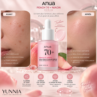 ANUA Peach 70 Niacin Serum — 30 ml