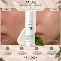 ANUA Heartleaf 70% Daily Lotion — 200 ml