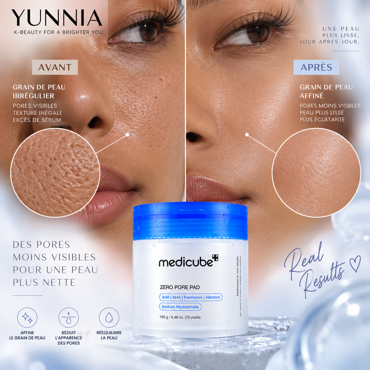 MEDICUBE Zero Pore Pad 2.0 — 70 pads